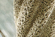 Sea Shell &mdash; surface detail